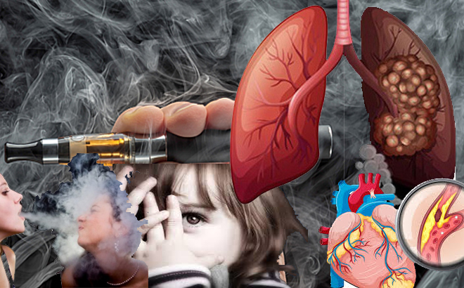 Thuốc lá điện tử gây hại cho tim và phổi